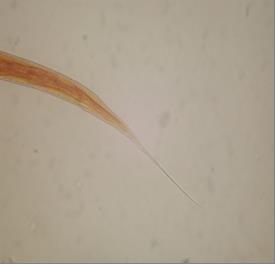 Fig. 2 Posterior end of Haemonchus contortus 3erd stage larve (x400)